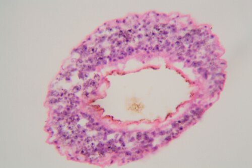 Schistosoma mansoni