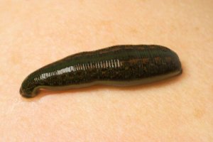 Hirudo medicinalis: a sanguessuga medicinal