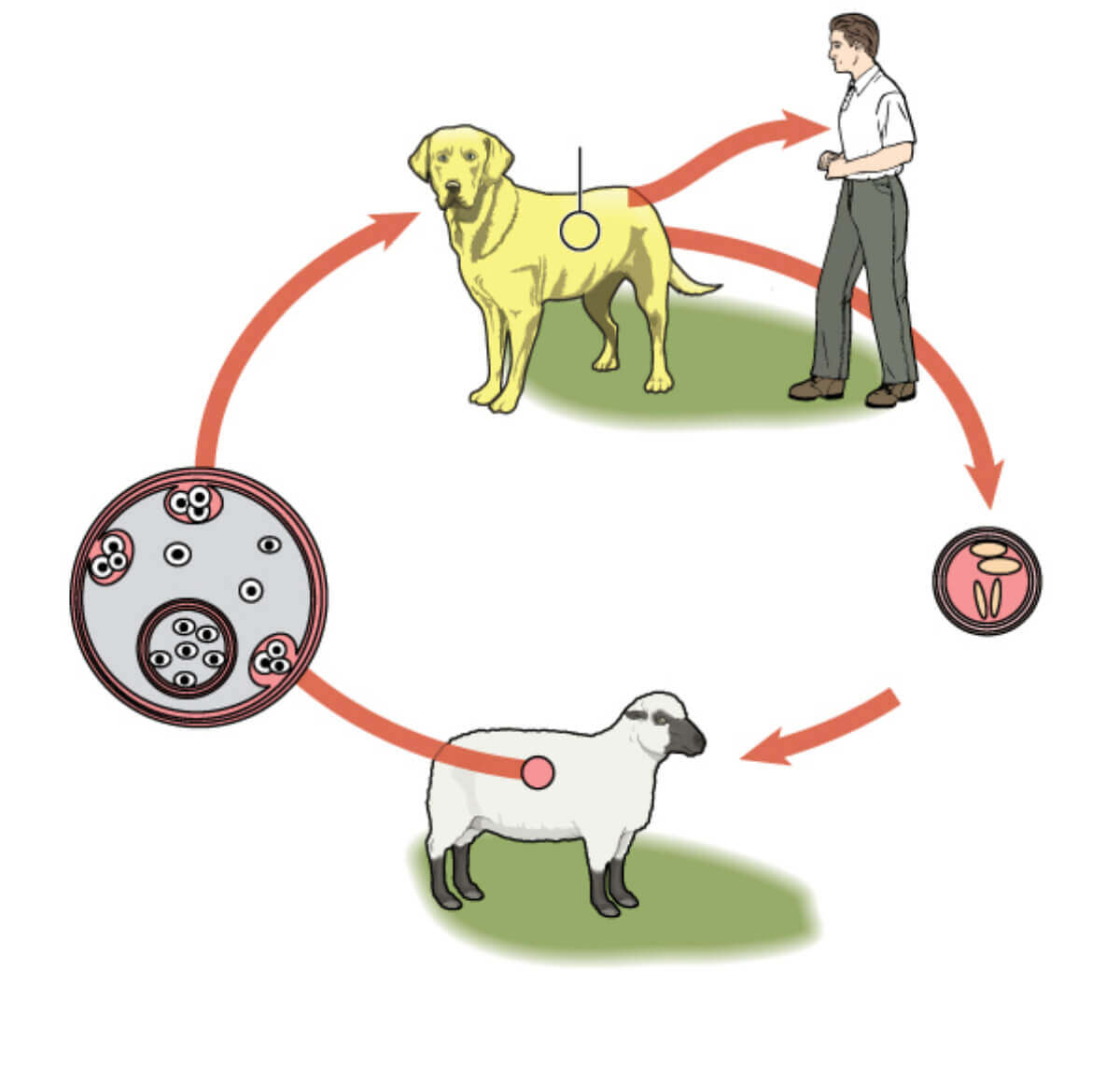 Hidatidose: uma doença parasitária que tende a ressurgir